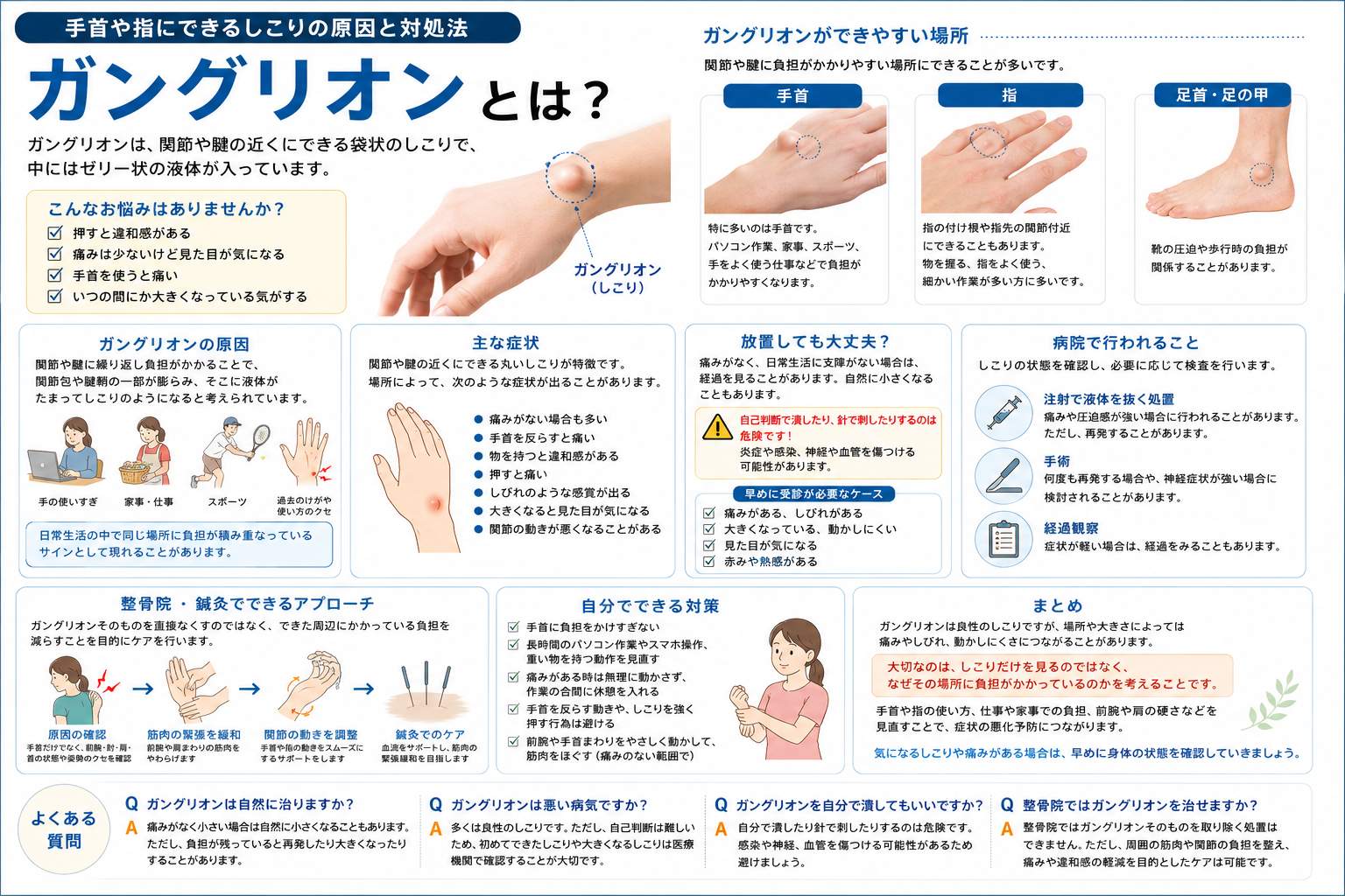ガングリオンとは？手首や指にできるしこりの原因と対処法